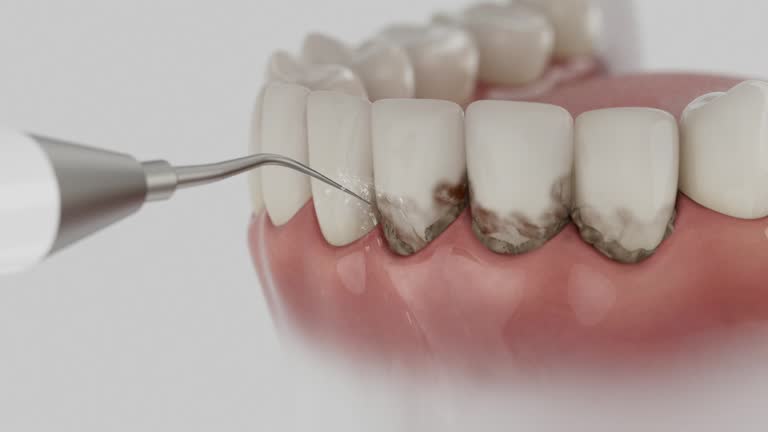 Reliable Dental contractor in Whittier, CA by Smile Center Dentistry